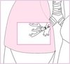 Lung microbiome emphysema patients endobronchial valves