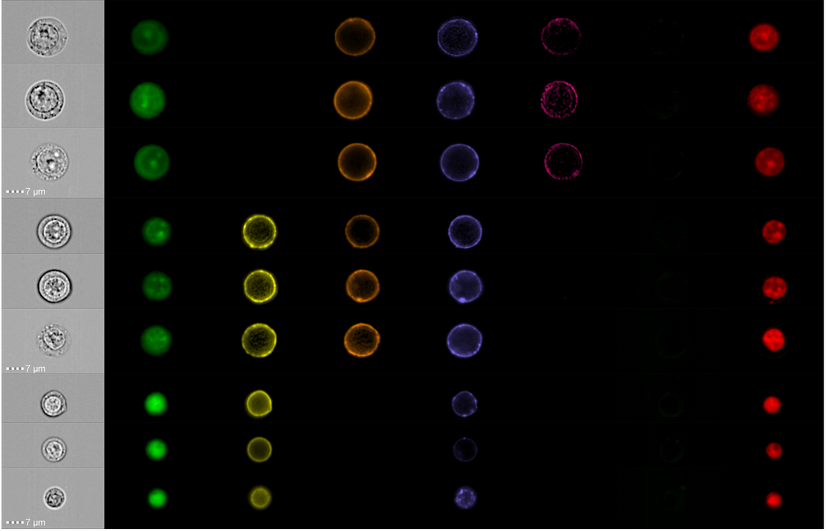 Image gallery illustrating the immunophenotypic and morphometric delineation of erythroid intermediates in healthy controls
