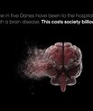 The major public diseases such as depression and stress affect many people, and it is also people with the diseases that cost society the most. In 2015, people with depression alone cost society more than ten billion kroner. Photo: Health Kommunikation.