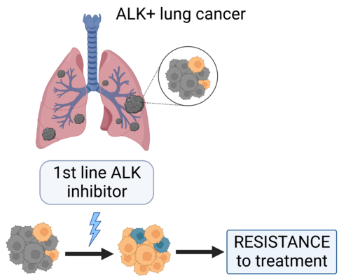 ALK+ Lung cancer