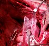 Mitral valve cormatrix