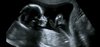 Fetal Medicine and Fetal Diagnostics