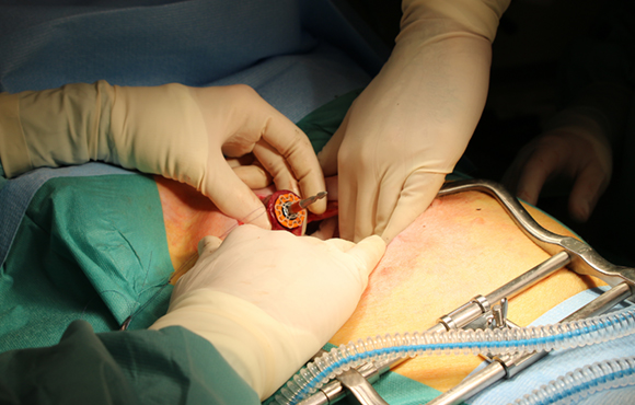 Implantatet er fremstillet af polycaprolactone, som allerede er godkendt til implantatbrug. Det passer til alle de specielle clipsemaskiner, der findes på markedet for operationsudstyr. Foto: Marianne Lie Becker.