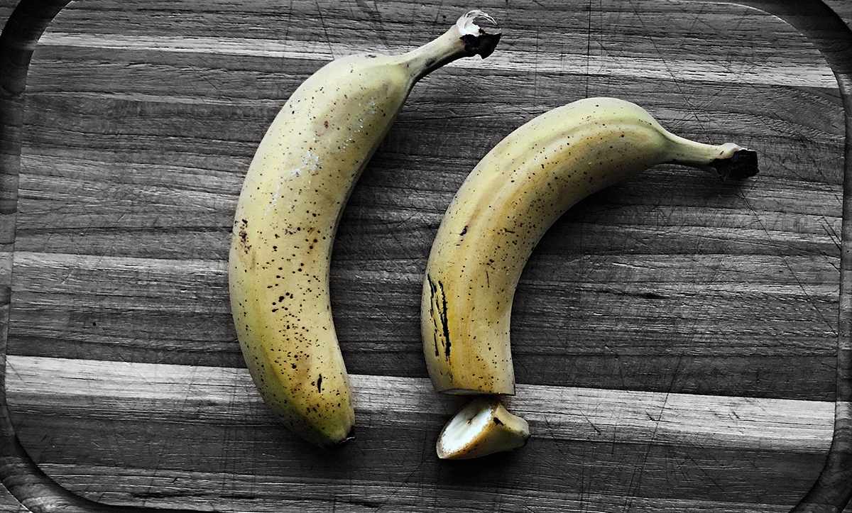 I Danmark gennemføres knap 4000 omskæringer af medicinske grunde, blandt andet på grund af forhudsforsnævringer, og det vurderes, at der årligt finder 2.000 rituelle omskæringer sted. Det sidste tal er dog behæftet med stor usikkerhed, da indgrebet